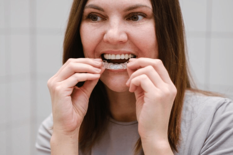 set of retainers
