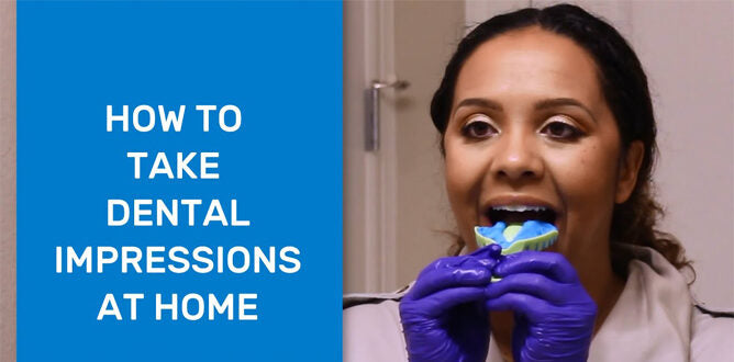 Lasting Impressions: Getting a Mold of Your Teeth