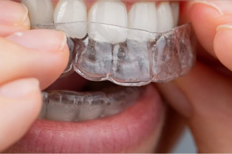 invisible orthodontic appliance.