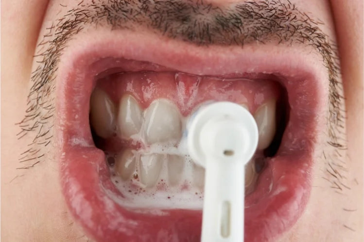 teeth polishing