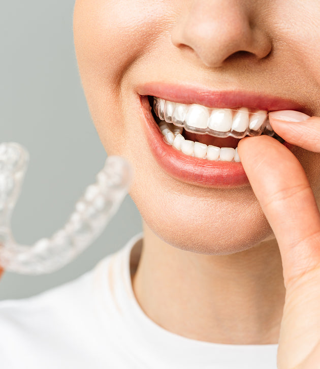 Invisible Braces(Clear Aligners)