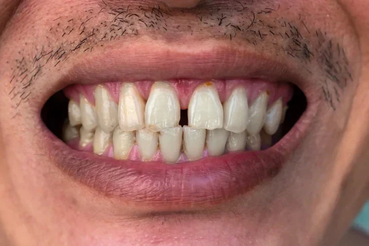 Closeup of a man showing his gap teeth