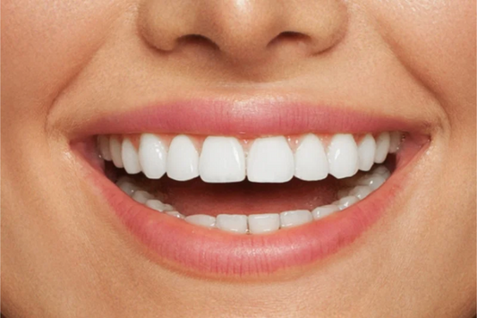 Close-up of a bright white smile with straight teeth