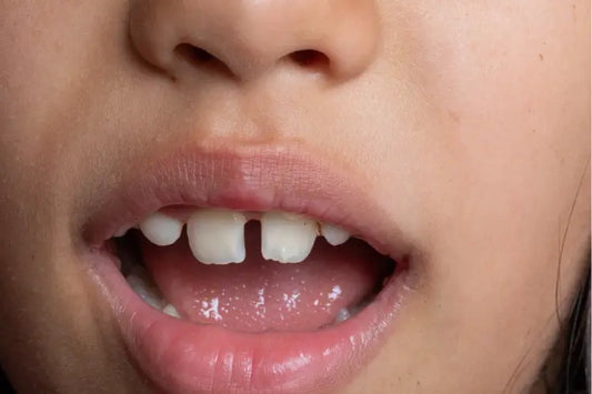 A child with a gap between front teeth