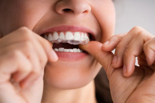 Clear Aligners.