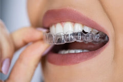 5 Signs It Is Time to Replace Your Teeth Grinding Guard