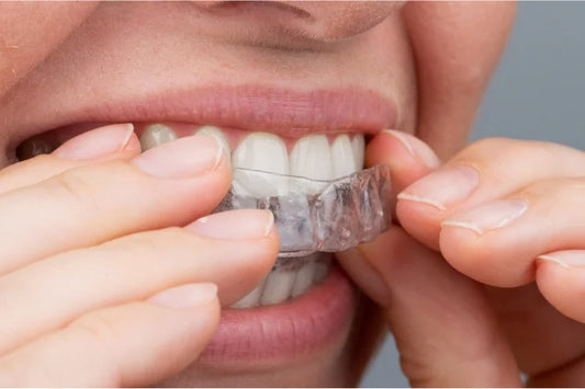 A girl putting on clear aligners for teeth straightening