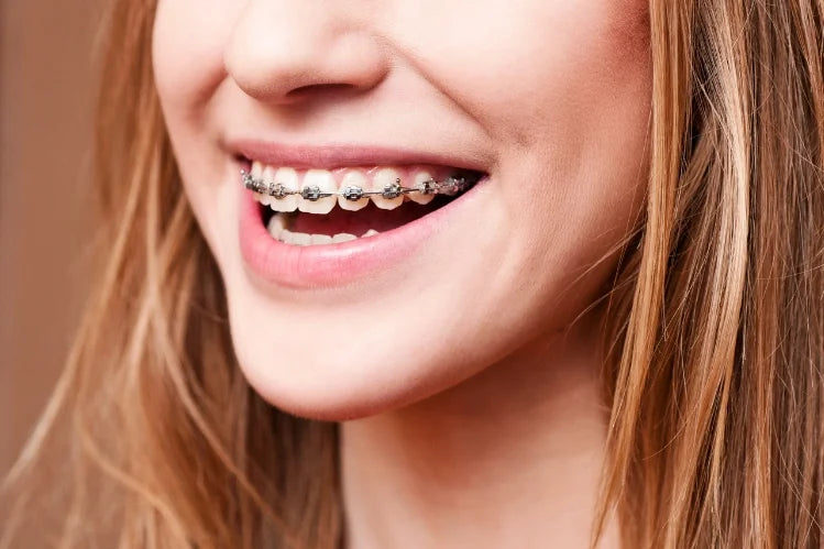 A girl smiling with metal braces