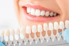 Teeth Whitening Treatments: How They Work and Their Effectiveness