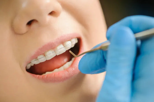 A woman with ceramic braces getting checked by a dentist
