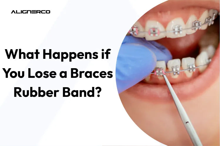 What Happens if You Lose a Braces Rubber Band?