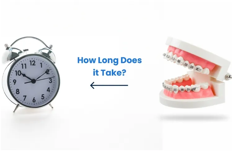 How long do braces take to work?
