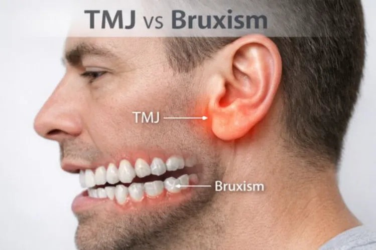 A side profile of a man's face illustrating the difference between TMJ and Bruxism. 