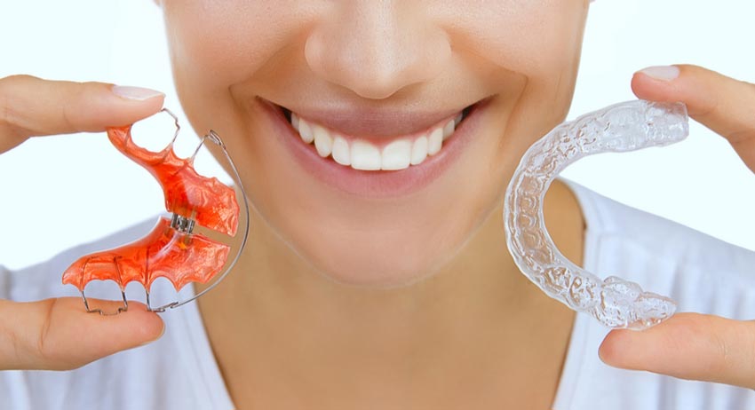 Can You Get A Fixed Retainer After The Clear Aligners Treatment?