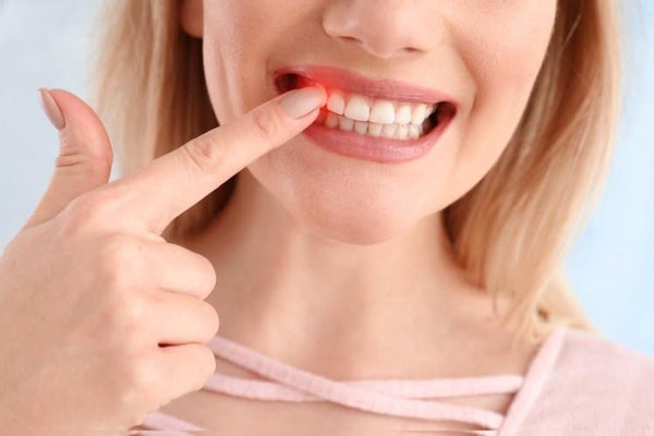 Can Gum Inflammation Affect Clear Aligner Tracking?