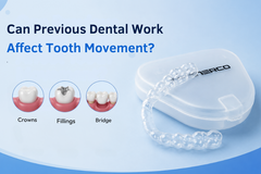 Can Previous Dental Work Affect Tooth Movement?
