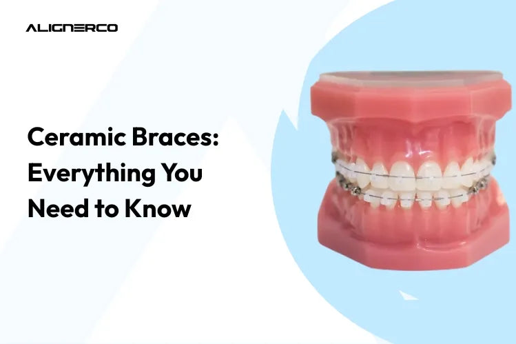  Ceramic braces on a teeth model 
