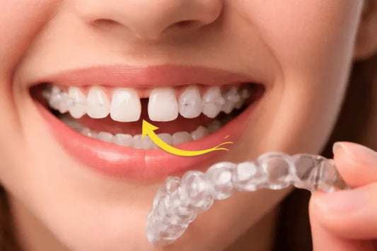 Gap in teeth after braces.