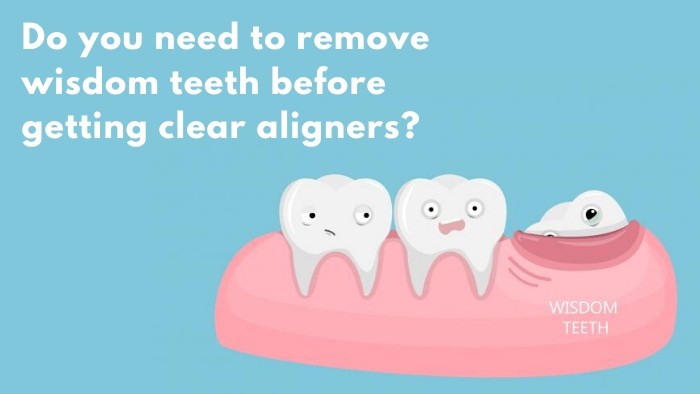 Can I wear my aligners with my wisdom teeth?