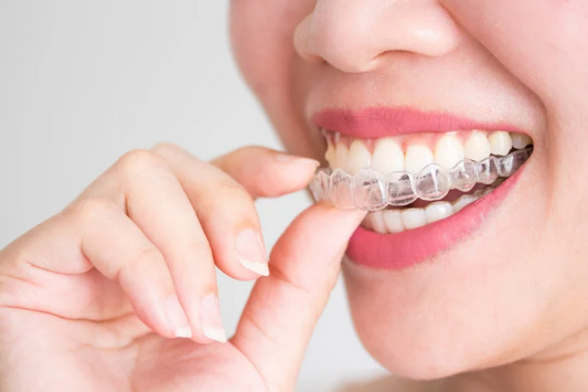 Woman placing a clear aligner on her teeth while smiling
