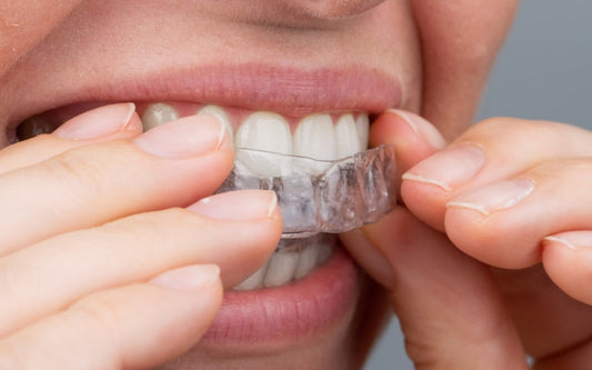 A girl applying clear aligners for at-home teeth straightening.