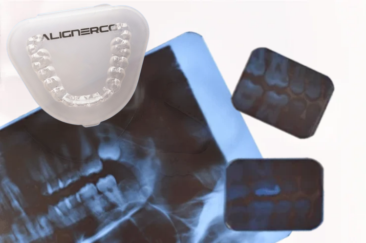 ALIGNERCO aligner case beside dental X-rays on a blue background