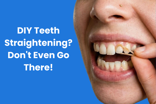 Placing a Rubber Band around Front Teeth
