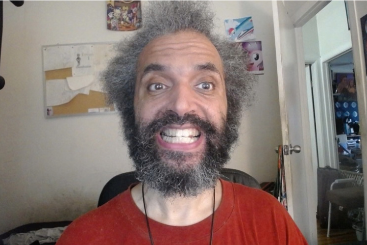 David Silver wearing an ALIGNERCO Clear Aligner tray