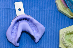 A Guide on NOT Wasting Your Dental Impression Putty