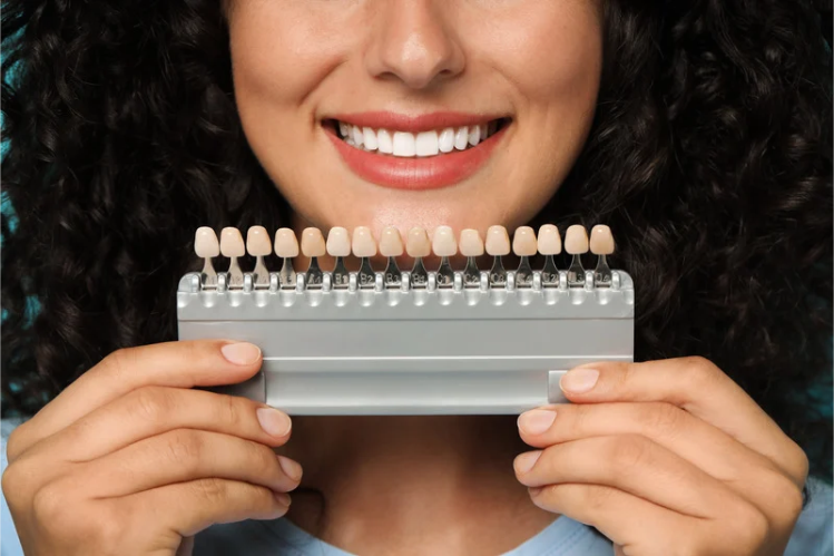 Smiling woman holding a veneer shade guide in front of her teeth