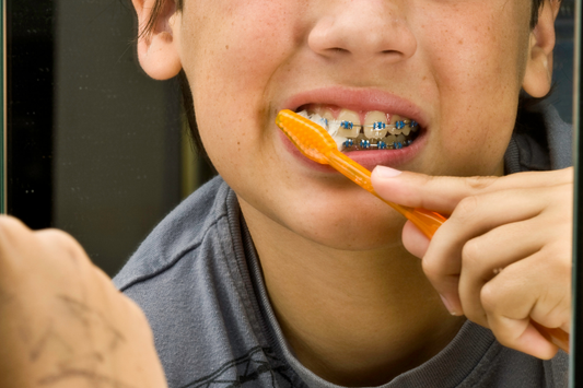 Teen with braces brushing teeth with an orange toothbrush