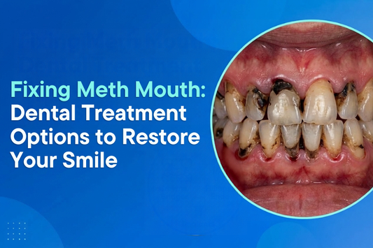 Close-up of decayed teeth showing meth mouth damage