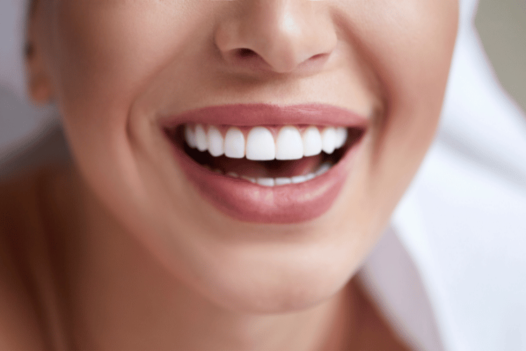 Teeth Straightening