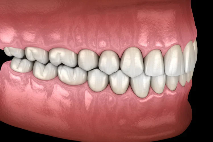 Healthy human teeth with normal occlusion, side view.