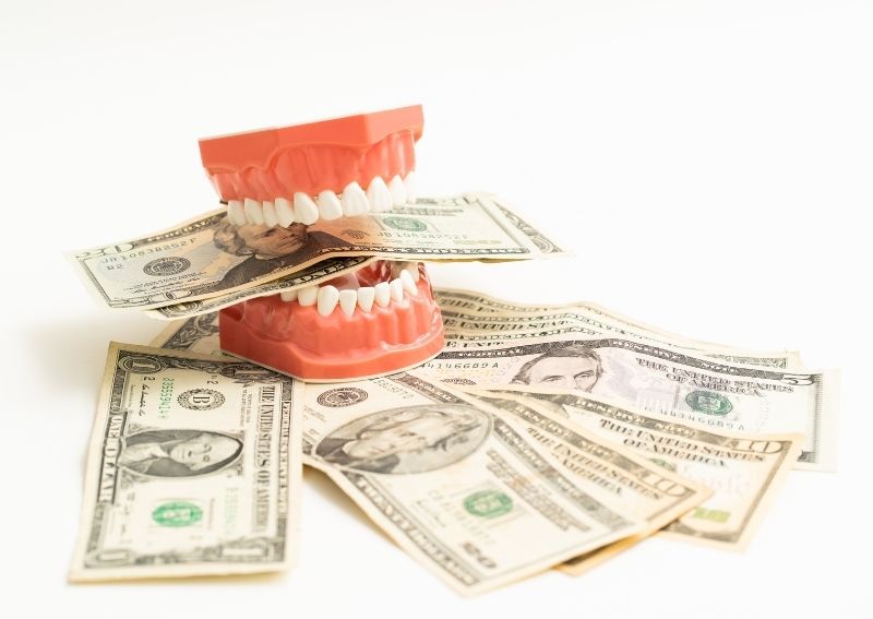 How Much Do Braces Cost per Month? Everything You Need to Know