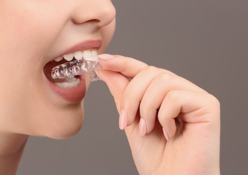 How to Avoid Dry Mouth With Invisible Aligners