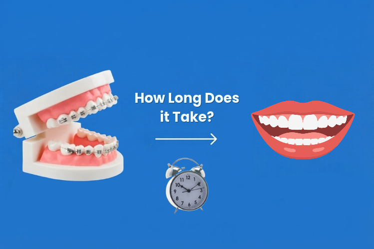 Braces model, alarm clock and straight smile on blue background