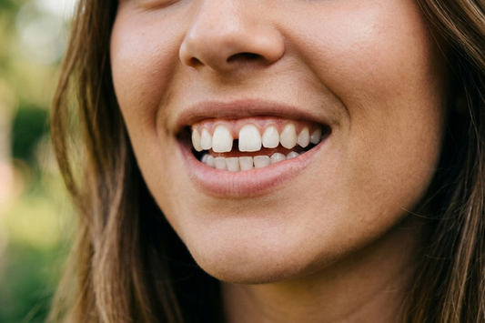 Smiling woman with a small gap between her front teeth
