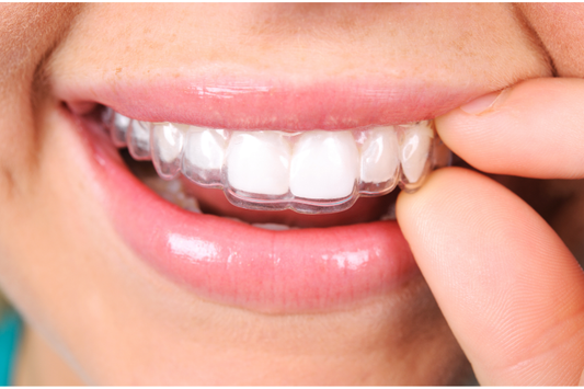 Finger fitting a clear retainer over straight upper teeth