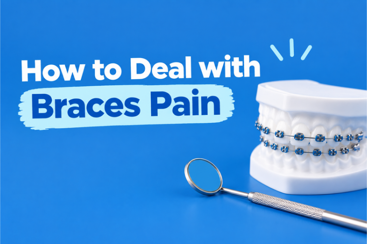 Braces on a dental model beside a mouth mirror on a blue background