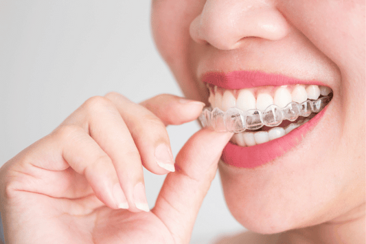 Clear Aligners for Sensitive Teeth: Straightening Comfortably