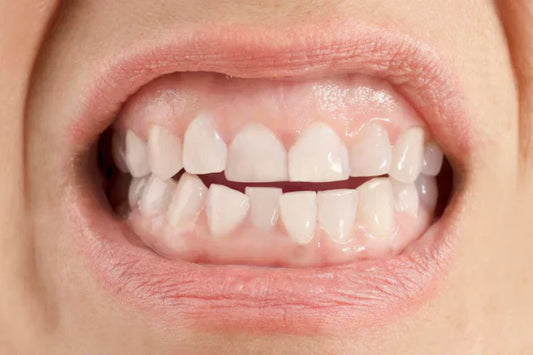 person showing misaligned front teeth