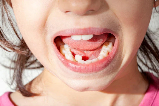 A young girl showing her snaggletooth