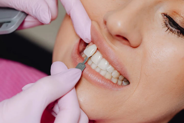 Dentist placing a no-prep veneer on a smiling woman's teeth