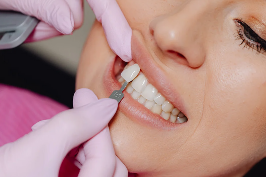 Dentist placing a no-prep veneer on a smiling woman's teeth