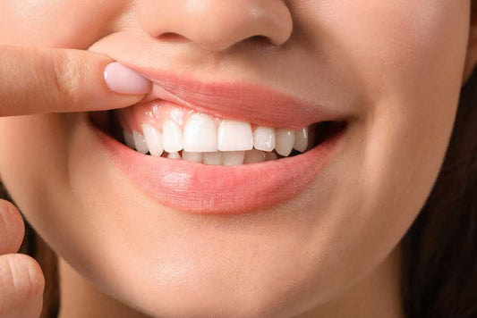 Periodontal-(Gum)-Disease