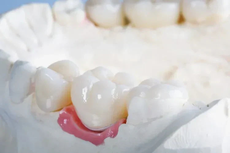 Picture of a dental crown