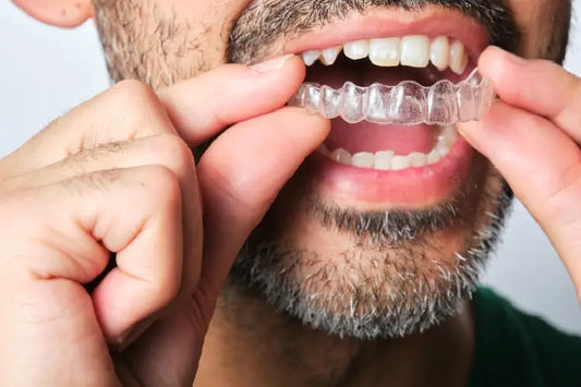 A close-up of a man wearing clear retainers.