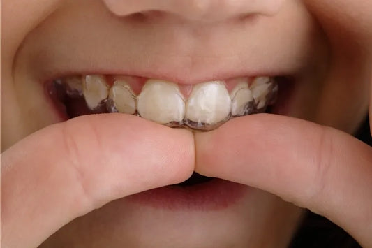 A person putting on retainers