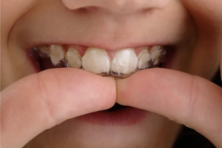 A person putting on retainers